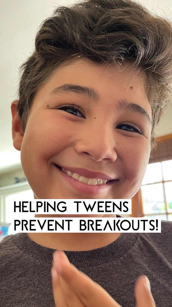 How to Help Tweens and Teens Prevent Breakouts!